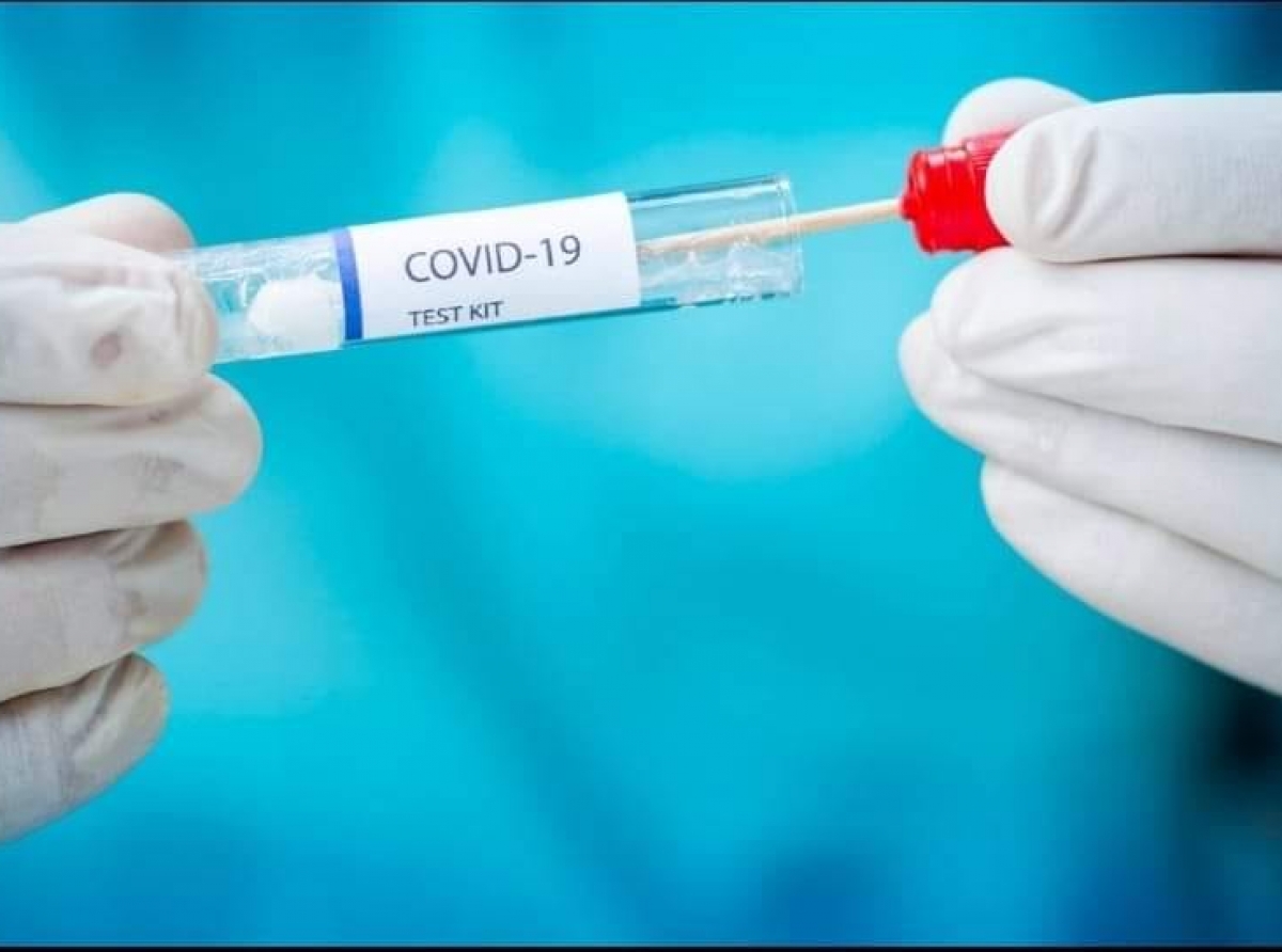 Pa esnan cu tin sintoma di COVID-19, test ta mas facil y accesibel awo