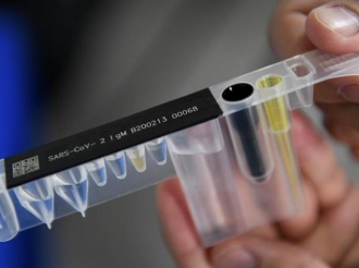 Januari 2022 lo ta un luna crucial pa loke ta aparicion di Omicron na Aruba