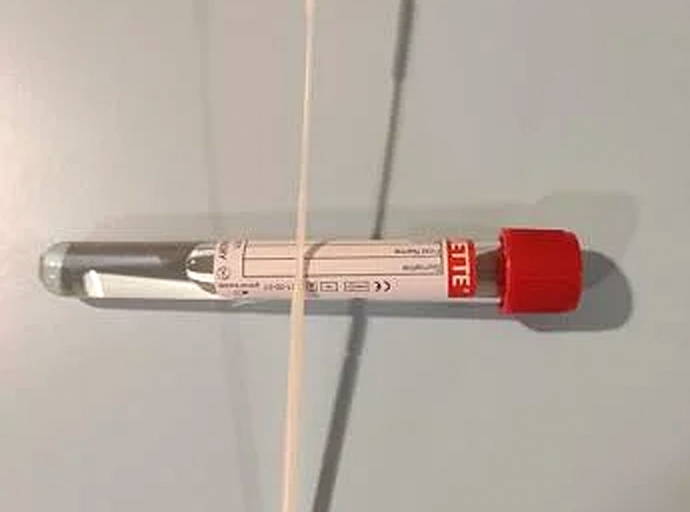 Testnan di PCR na New York ta dura 11 dia pa haya resultado