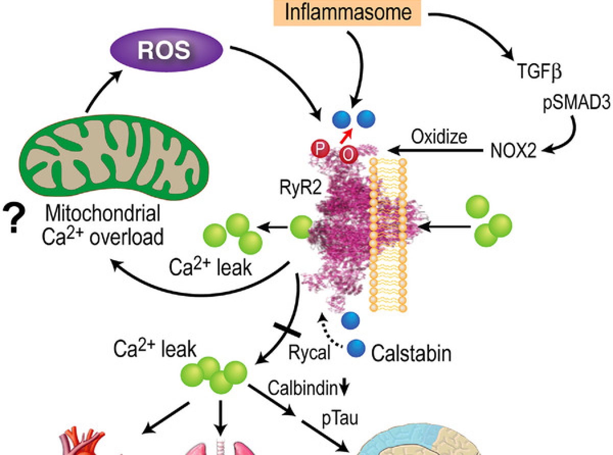 Cerebro di hende cu Covid-19 a sufri mesun cambionan molecular cu pashentnan di Alzheimer