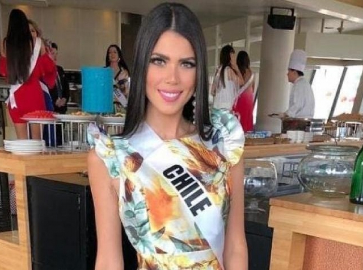 Participante di Miss Universe a mustra con cirugia a daña su cara completo