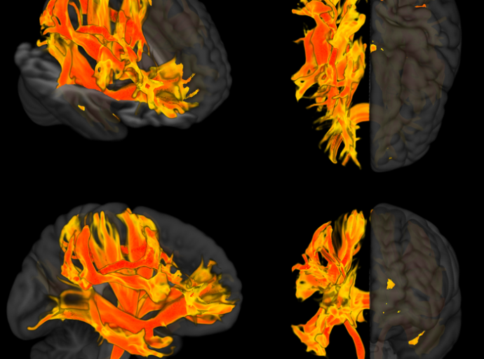 Rapport nobo a confirma cu presion halto di sanger ta yuda bo cerebro perde memoria