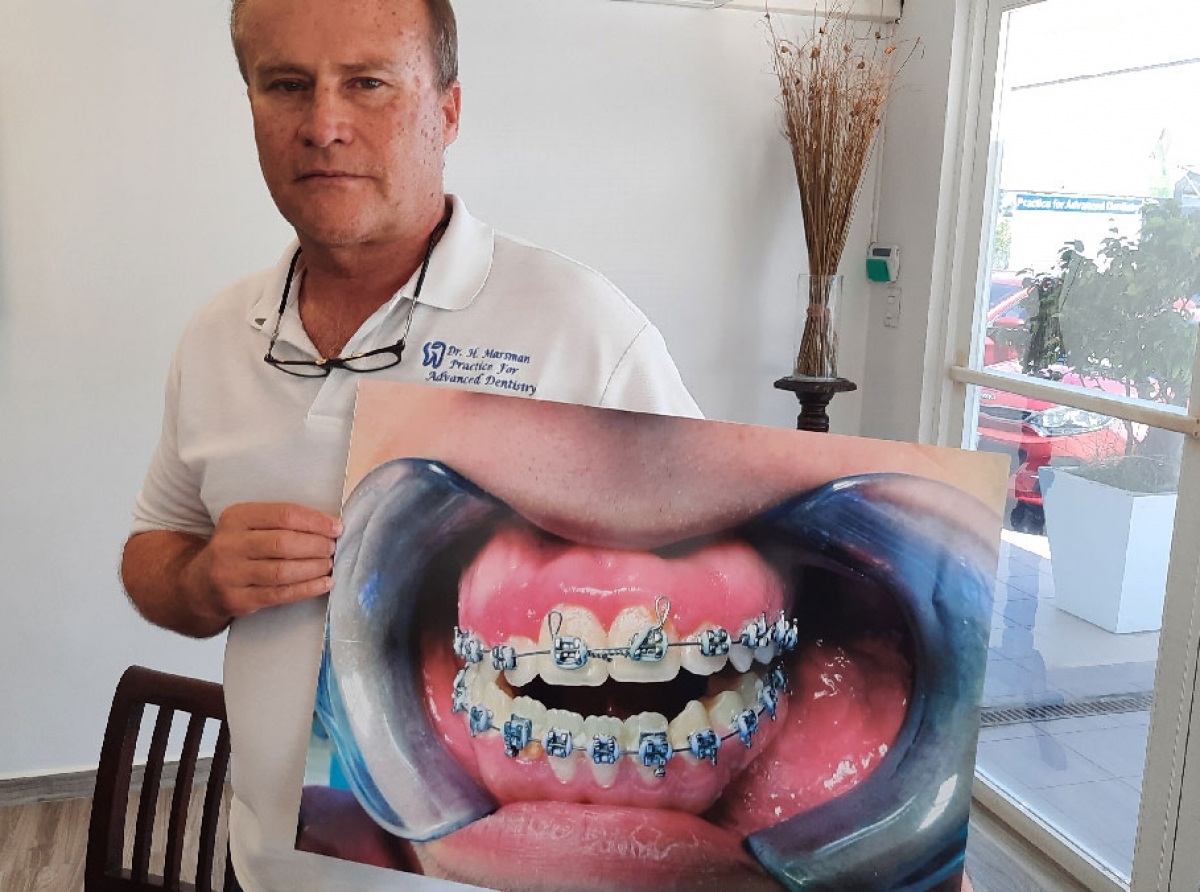 Tin fuerte indicacion cu tin mas dentista ta traha como orthodontista na Aruba y cu nan certificado ta cuestionabel