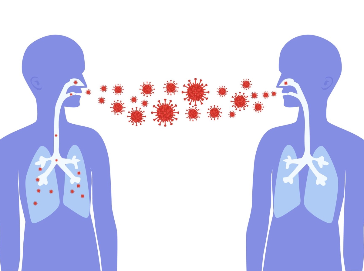 Un persona contagia cu Sarampi por infecta entre 15-20 persona na e mesun momento