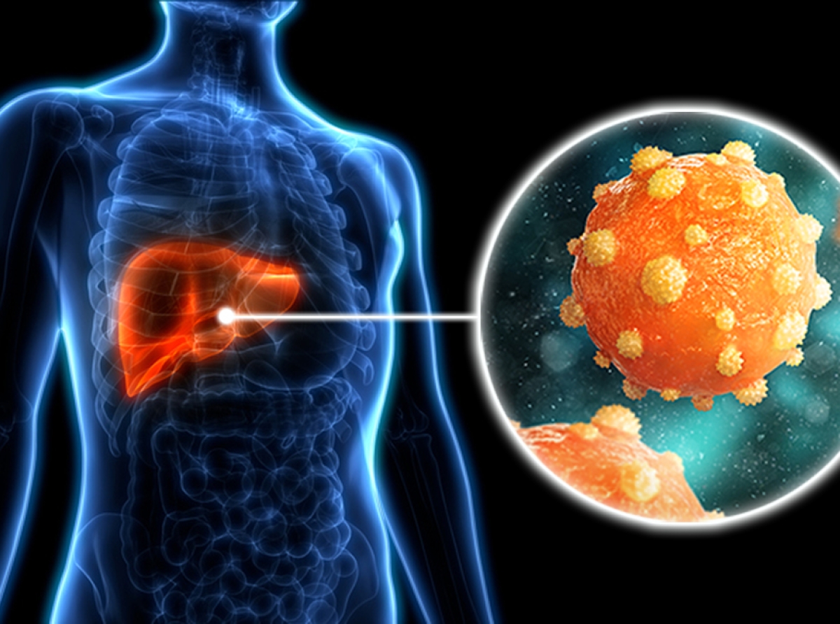 Organisacion Panamericano di Salud ta pidi pa amplia acceso na test y tratamento di Hepatitis viral