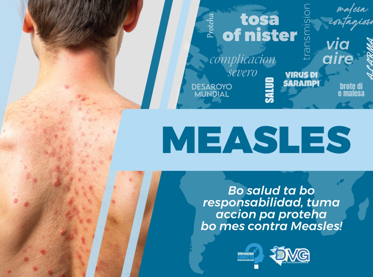 Departamento di Salud Publico trahando riba plan pa limita caso di Sarampi na Aruba
