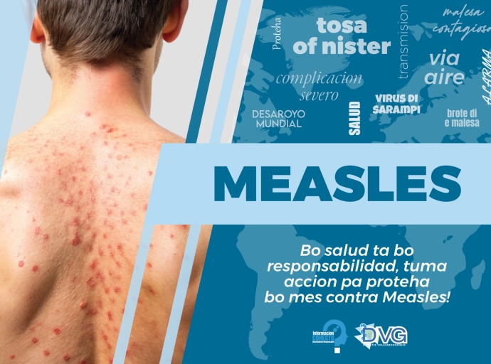 Departamento di Salud Publico trahando riba plan pa limita caso di Sarampi na Aruba