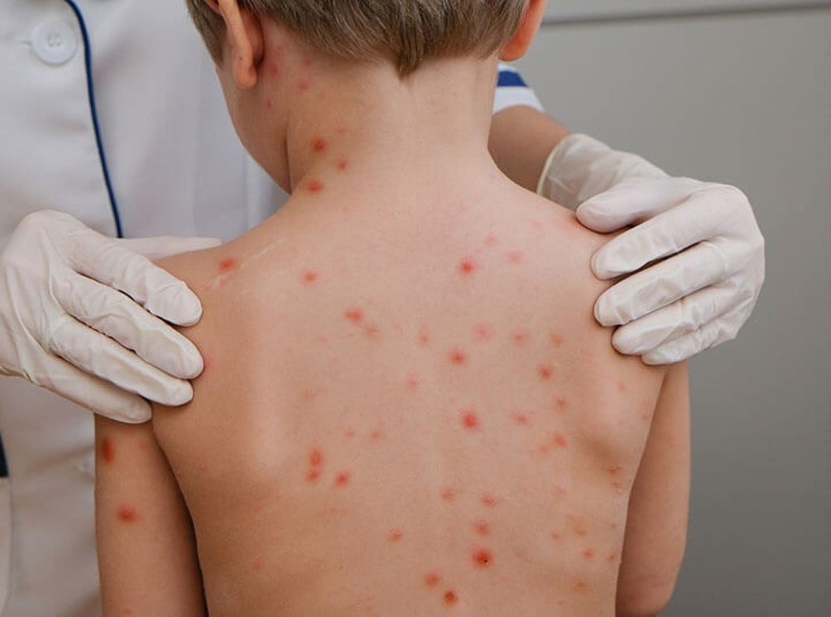 Varios mucha na scolnan preparatorio contagia cu malesa ‘Cendepaga’